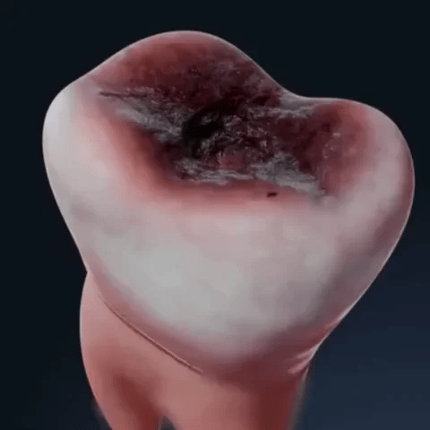 Dental Tooth Armor - demostración del producto